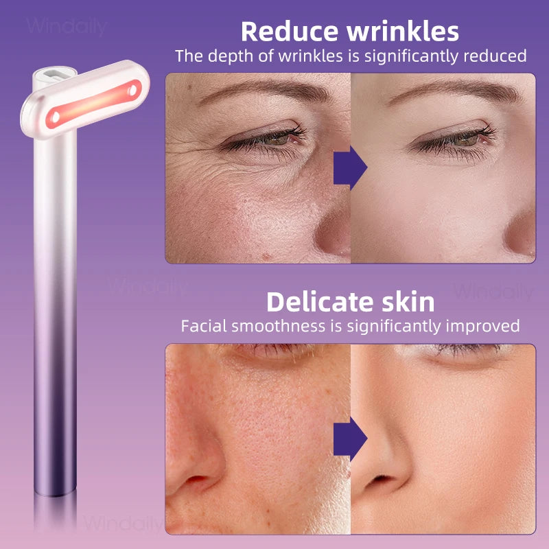 4-in-1 EMS Facial Lifting Wand